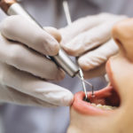 Desmineralização dental
